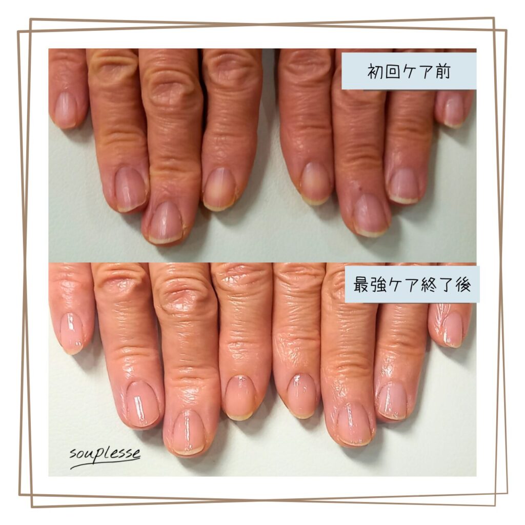 福島市 ネイルケアサロン スプレース 最強のネイルケア 自爪育成