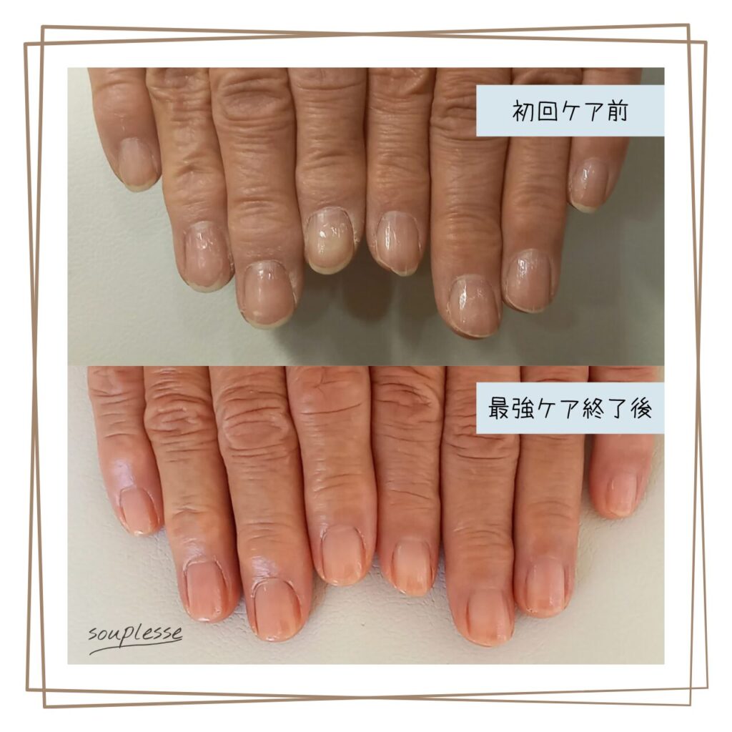 福島市 ネイルケアサロン スプレース 最強のネイルケア 自爪育成