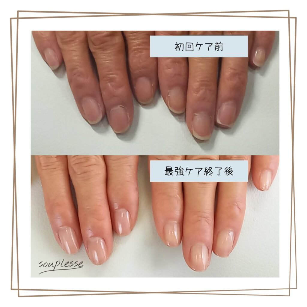 福島市 ネイルケアサロン スプレース 最強のネイルケア 自爪育成