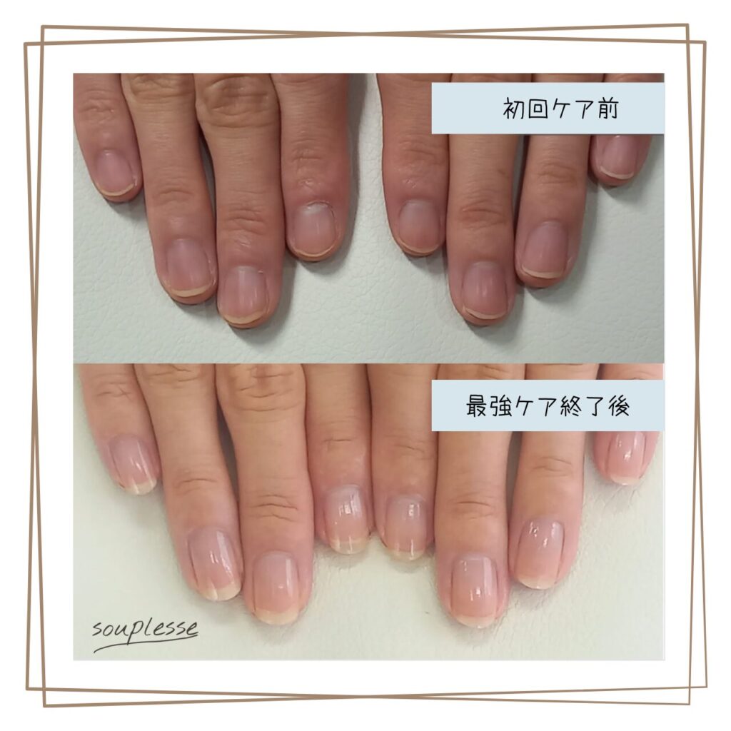 福島市 ネイルケアサロン スプレース 最強のネイルケア 自爪育成