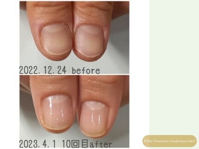 爪切り 使わない方がいい 爪 適切な長さ 爪やすり おすすめ