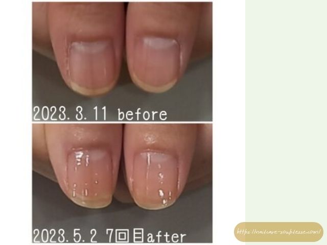 ネイルケア