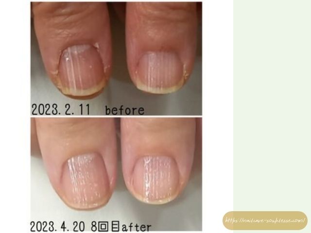 爪切り 使わない方がいい 爪 適切な長さ 爪やすり おすすめ