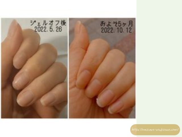 ジェルオフ 爪が薄くなる ダメージ 対処法