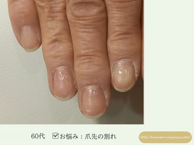 爪　エイジング　サイン　原因　美爪習慣　