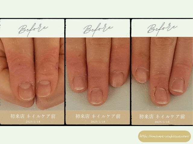 ネイリスト　健康な指先　爪周りの皮膚　硬くなる　原因　対処法