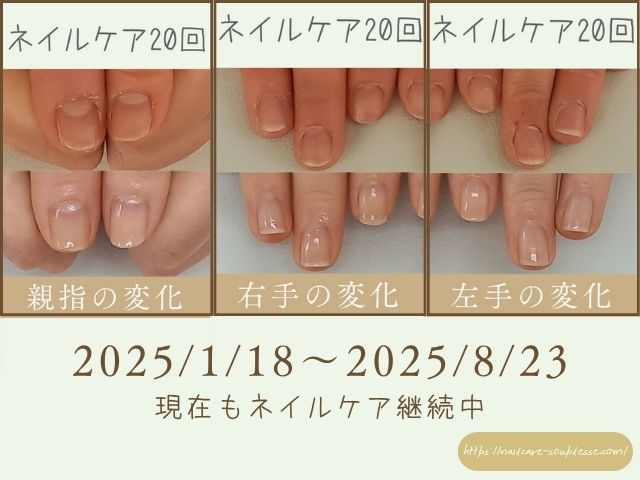 ネイリスト　健康な指先　爪周りの皮膚　硬くなる　原因　対処法