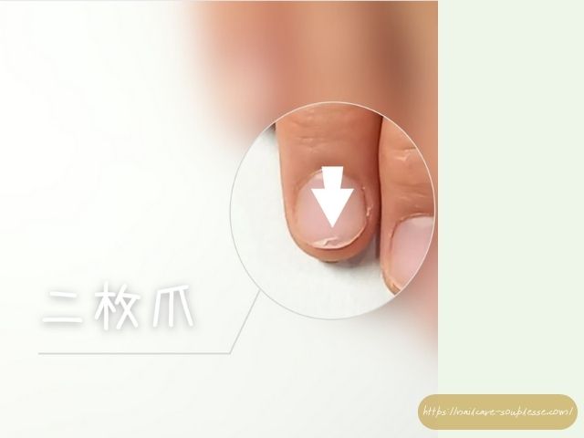 ささくれ　二枚爪　健やか　手元　習慣