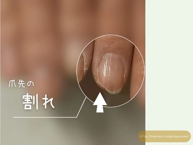 ささくれ　二枚爪　健やか　手元　習慣