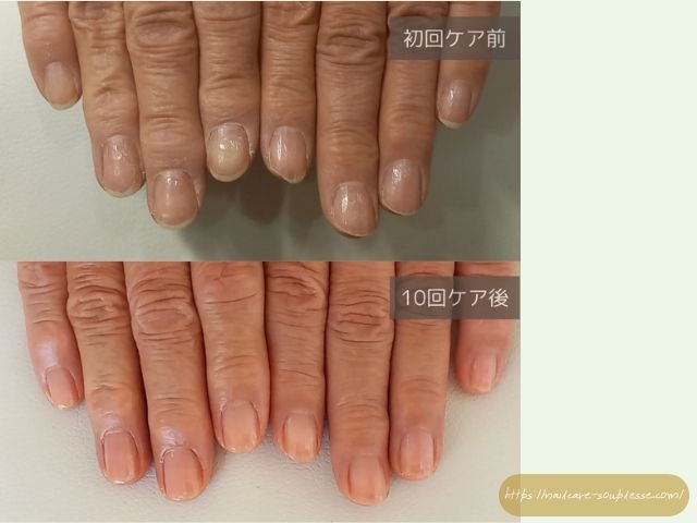 自爪　自爪育成　最強のネイルケア