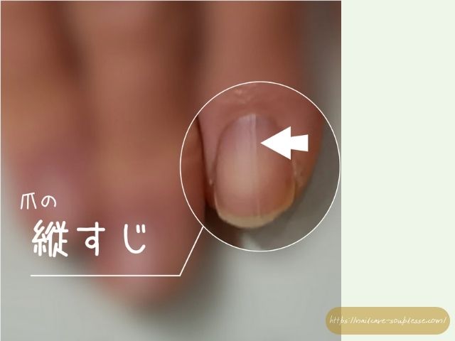 ささくれ　二枚爪　健やか　手元　習慣