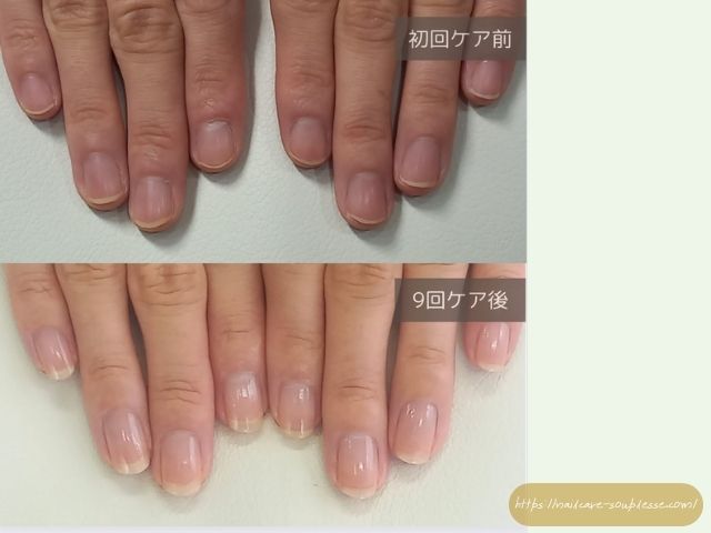 自爪　自爪育成　最強のネイルケア