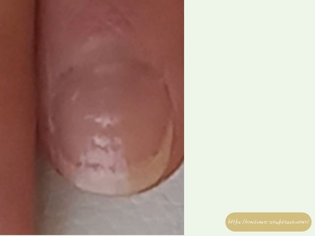 ささくれ　二枚爪　健やか　手元　習慣