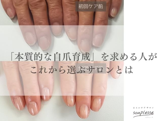欧州　TPO規制　自爪育成　ネイルケア
