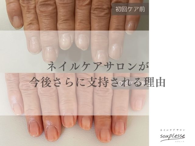 欧州　TPO規制　自爪育成　ネイルケア