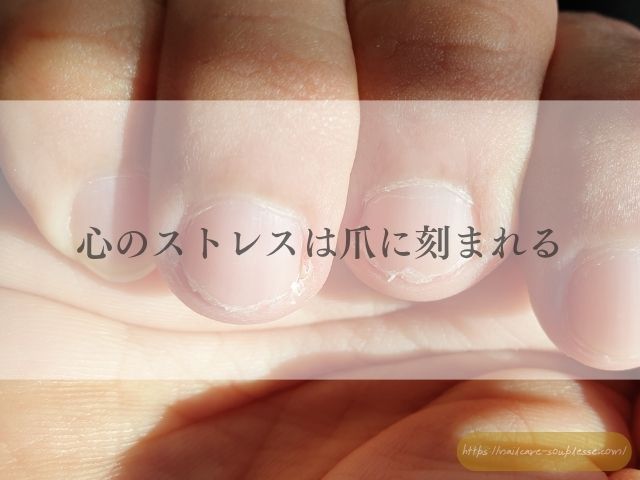 手　心を映す鏡　心理学　脳科学　手肌　爪　心　深い関係