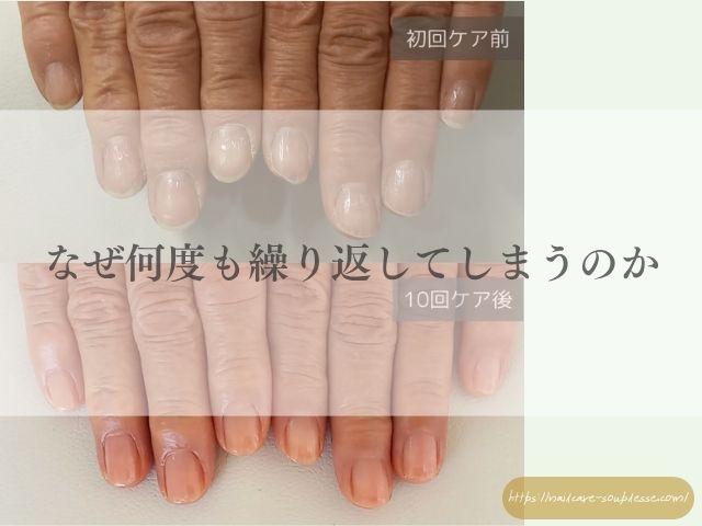 硬く 厚い爪 二枚爪 原因 ホームケア サロンケア 解説