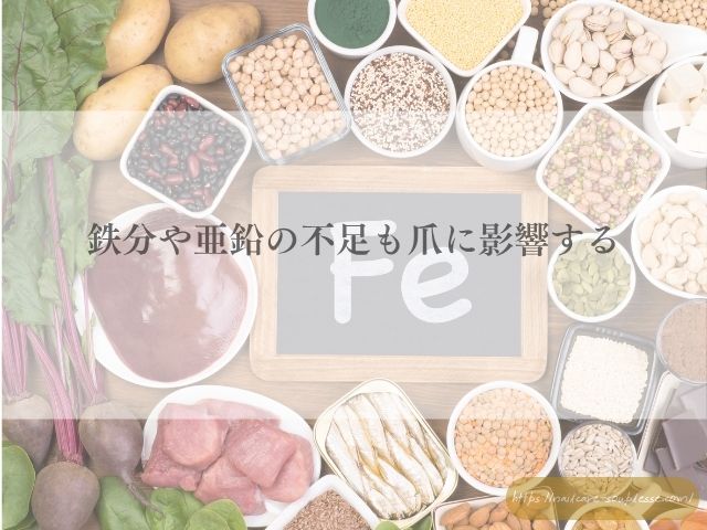 ダイエット 爪 ネイルトラブル
